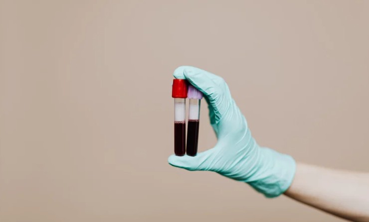 badanie przewodnictwa nerwowego